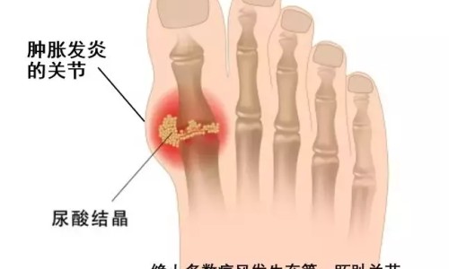 病人光喊死去的人好吗-病人说死去的拉她一起走网- 在医院病逝的老人拉回家好吗知识,分享病人老是说死去的人